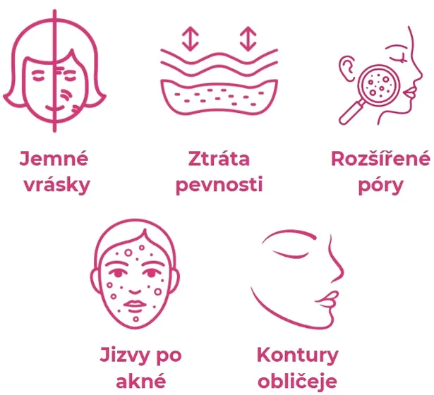 Výhody mikrojehličkování