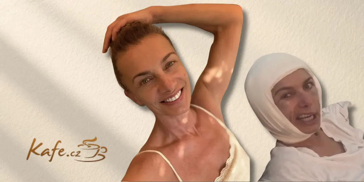 Alice Bendová ukázala děsivě ovázanou hlavu. Podstoupila Deep Plane Facelift
