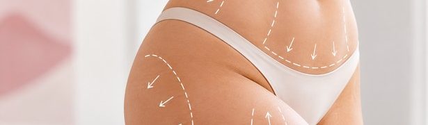 Card laserova liposukce