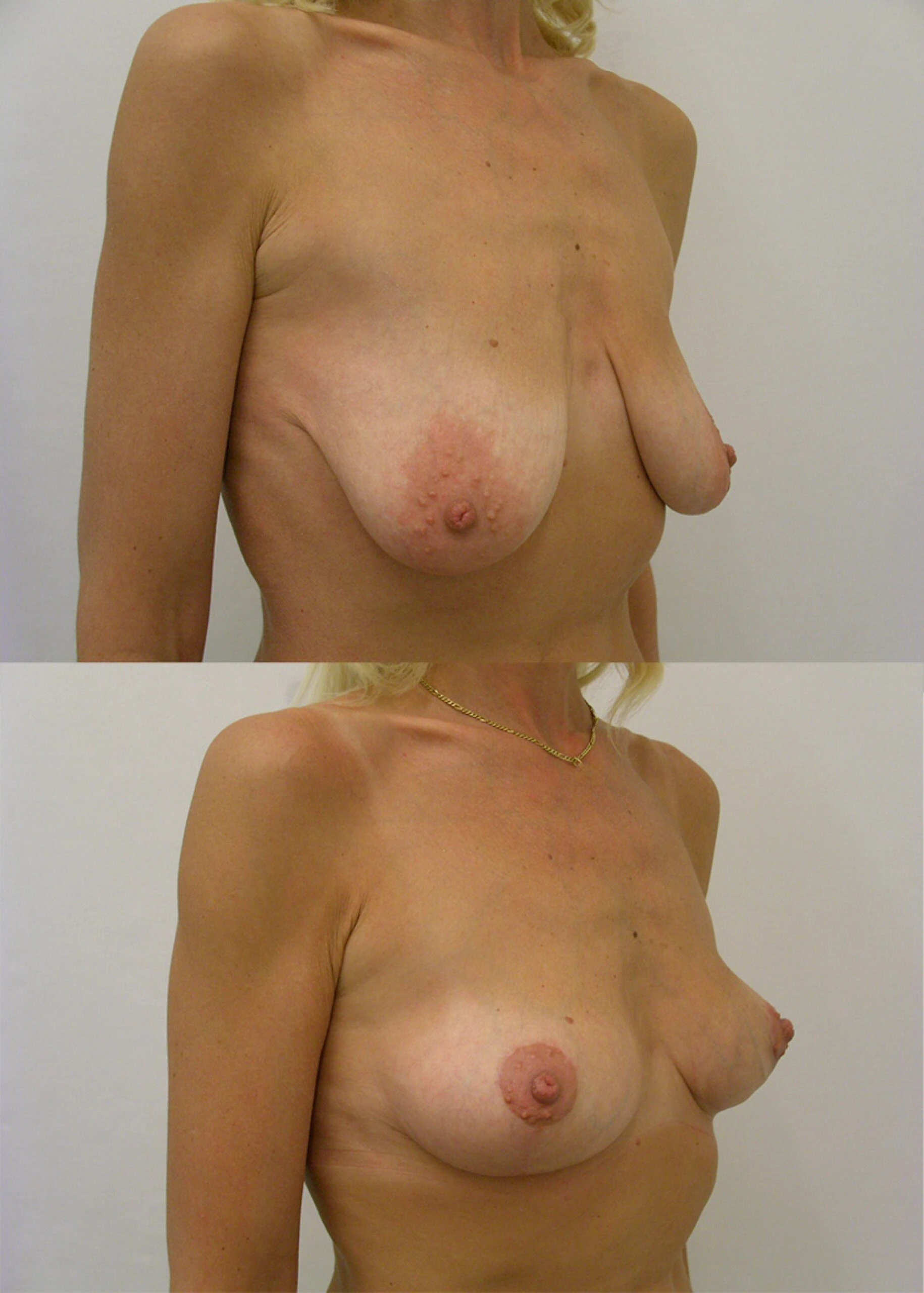 modelace prsou